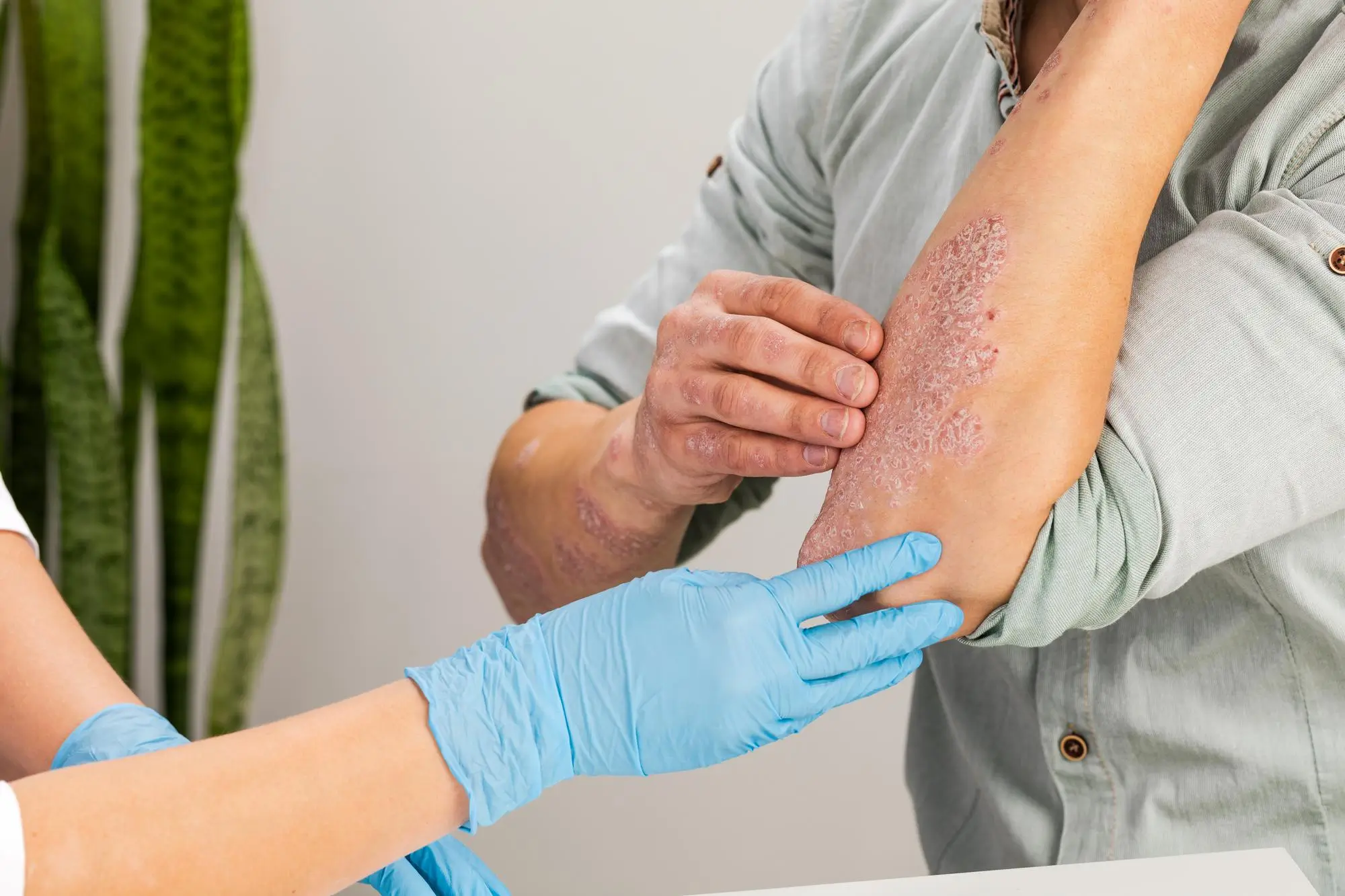 Wound Care Dressings At Your Doorstep