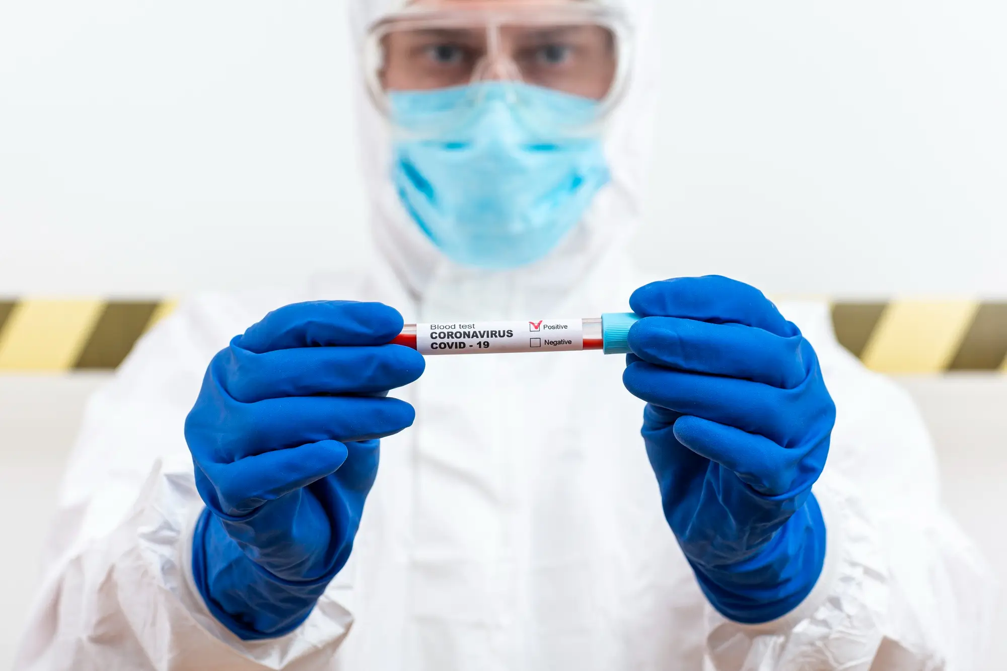 Covid PCR Test at Home