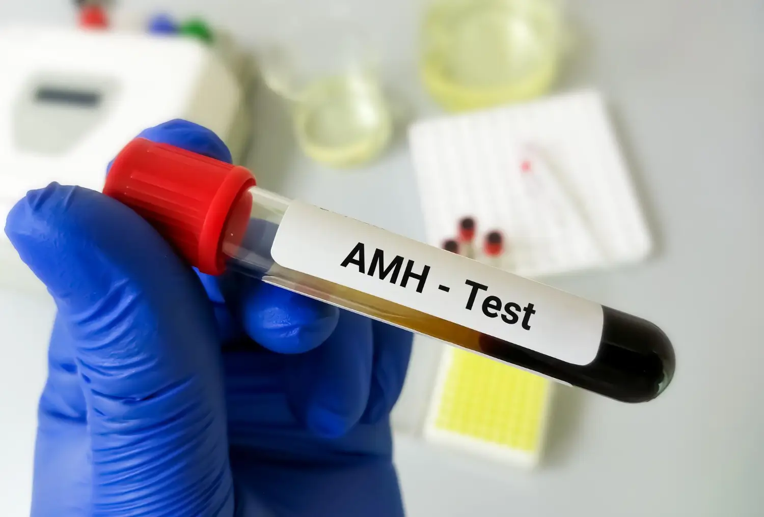 AMH Test - Track Your Reproductive Health