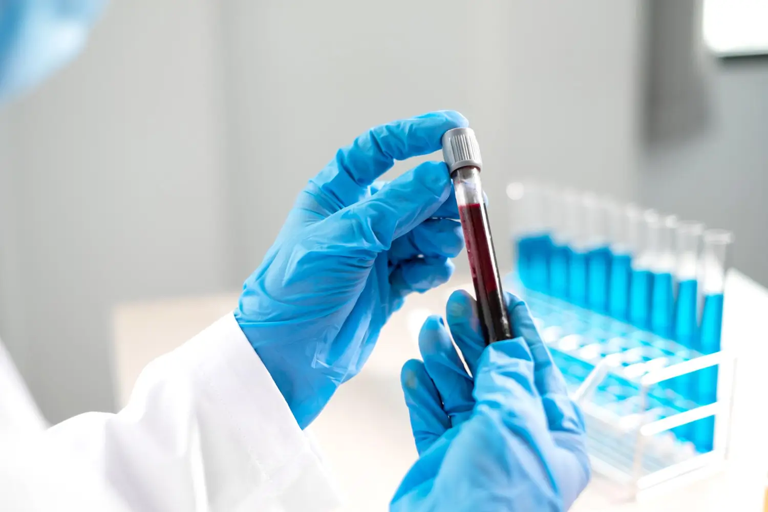 Track Fertility & General Health With Estradiol Test in Dubai