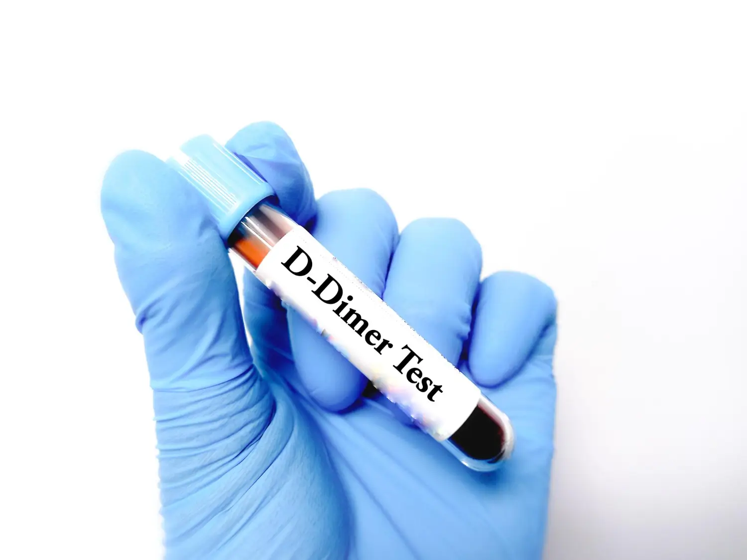 24x7, Dimer D Test At Home