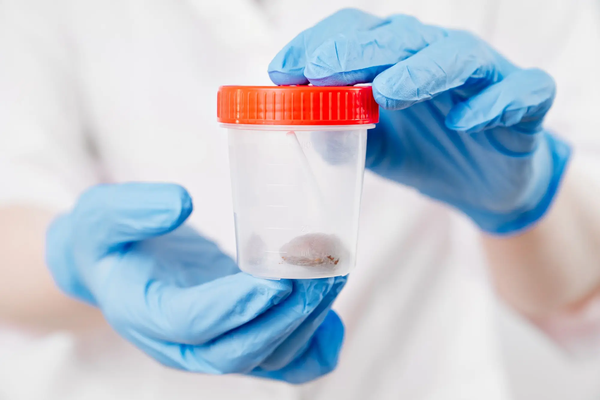 24x7 Stool Test At Home In Dubai, UAE