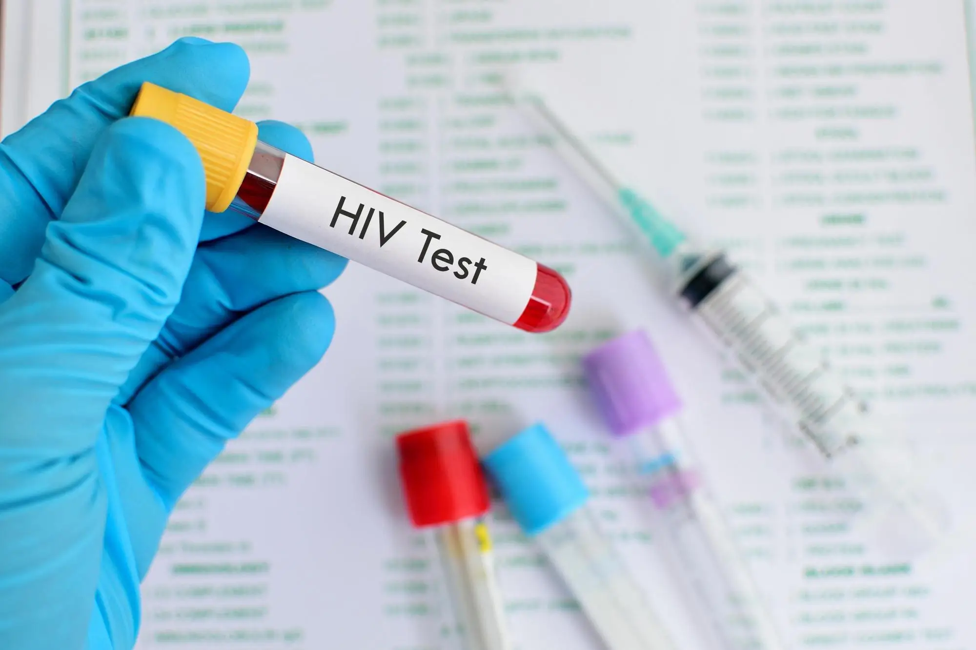 HIV Test At Home In Dubai With Privacy