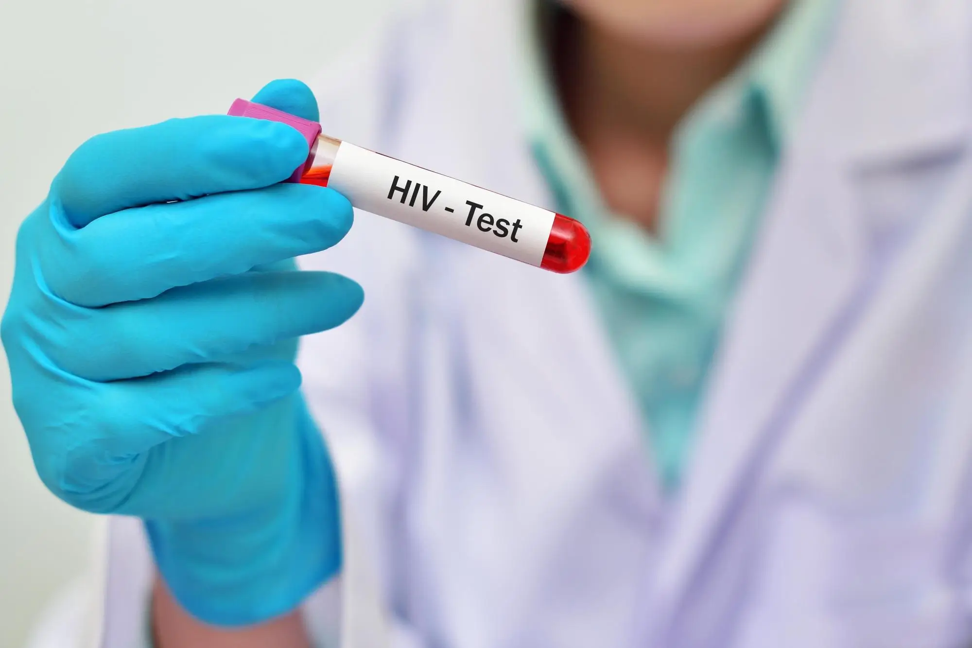 HIV Test At Your Doorstep