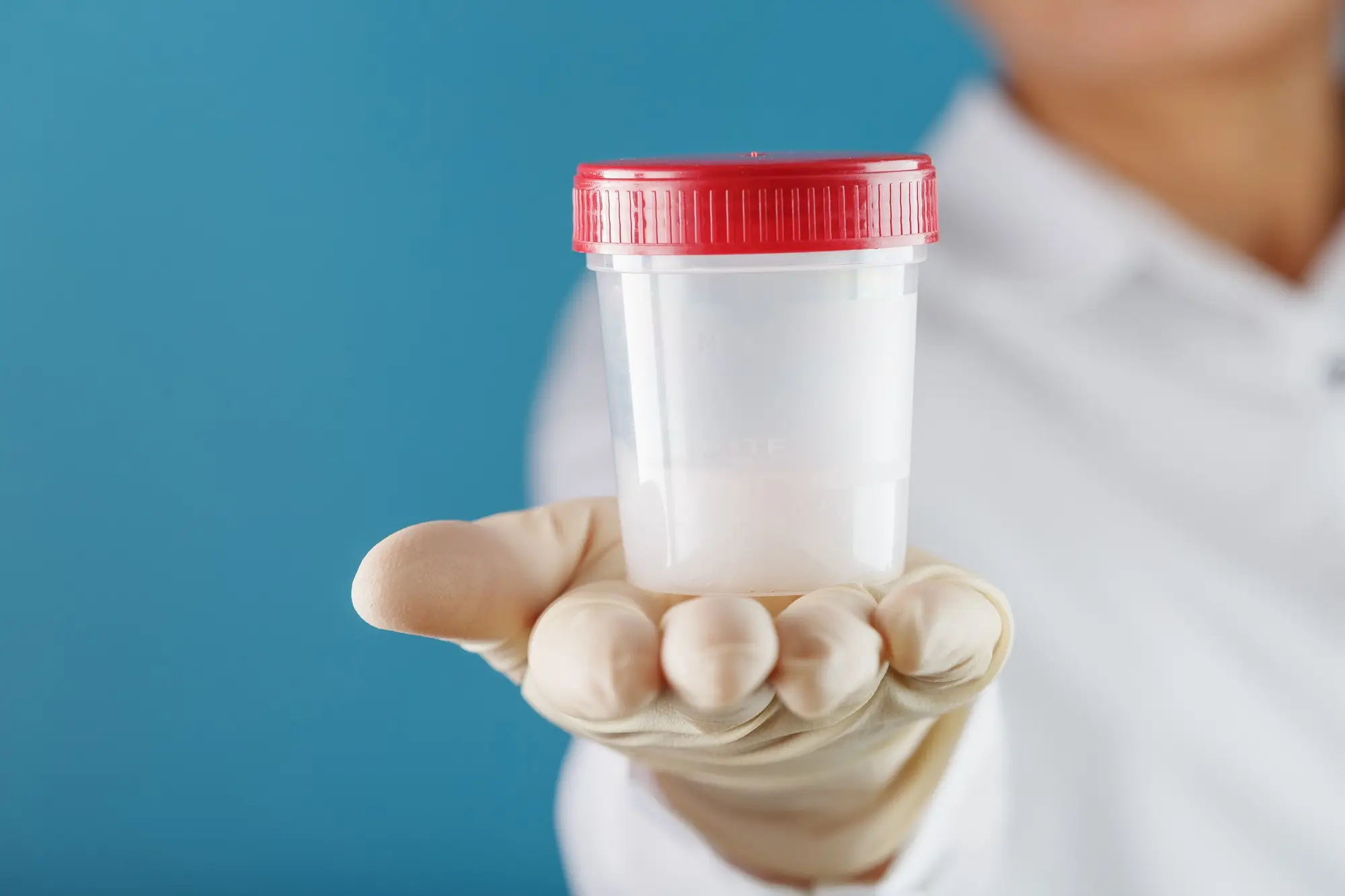 24x7 Stool Test At Home In Dubai