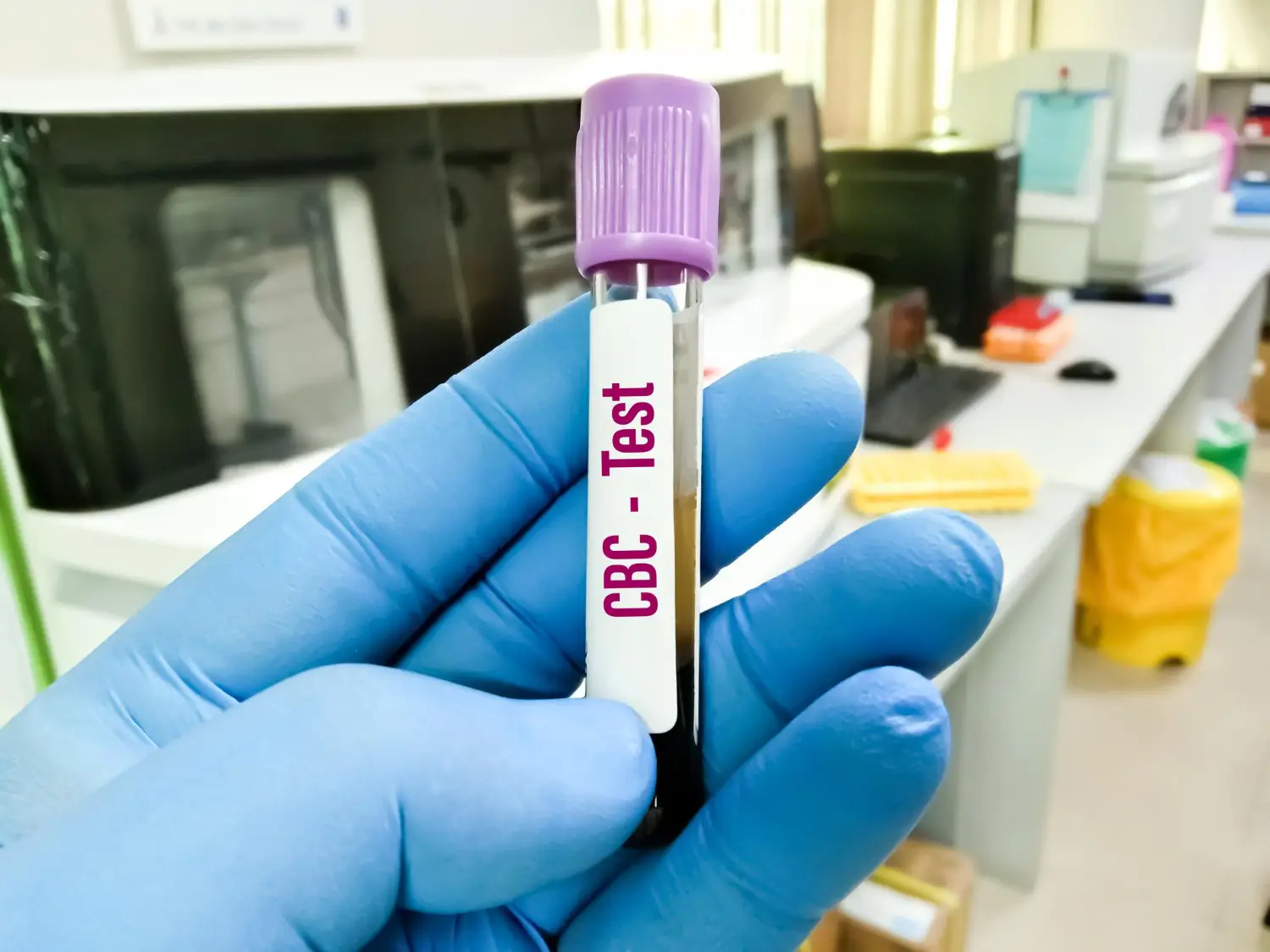 CBC Blood Test At Home In Dubai