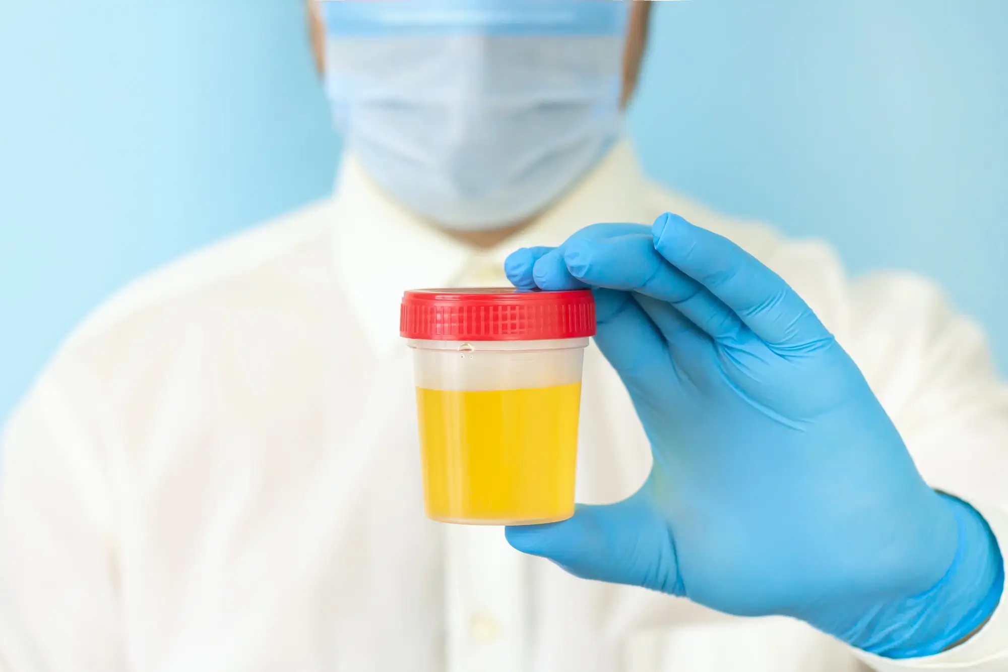 Urine Culture Testing or Urine Test in Dubai At Home