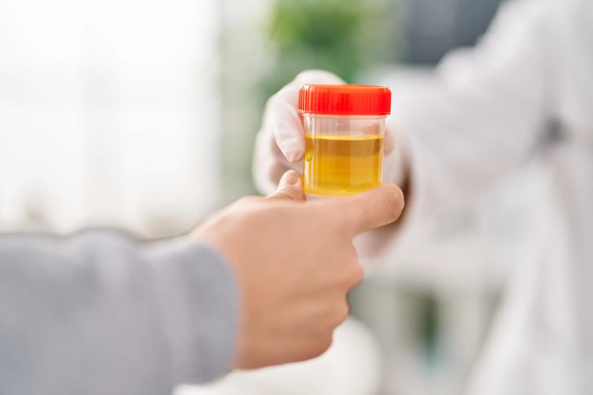 Urine Culture Test At Home In Dubai