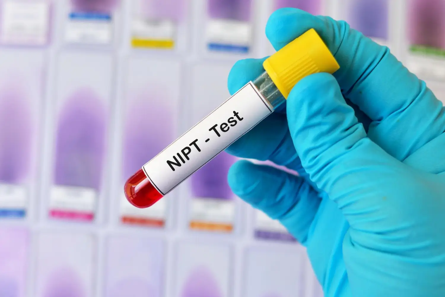 NIPT Test